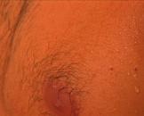 sex bilder gay